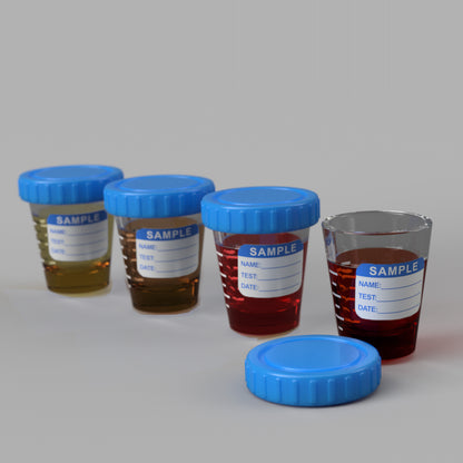 Hematuria Shot Glass Set (Pre Order)