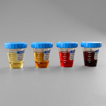Hematuria Shot Glass Set (Pre Order)